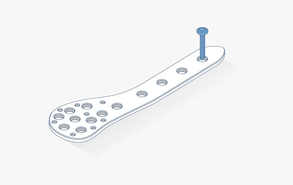 Fracture fixation plates